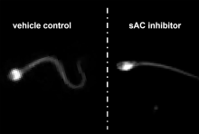 image of human sperm from video showing effects of male contraceptive drug candidate