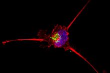 A triple-negative breast cancer cell