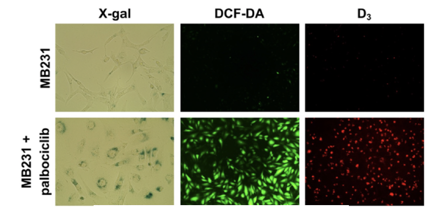 D3 detects palbociclib-induced senescence in vitro.