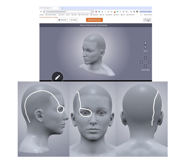 Rendering of mobile screening application, which allows for touch-enabled creation of pain drawings.