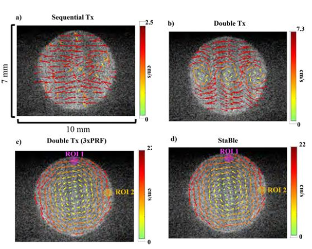 StaBle improves accuracy of the measured velocity of rotation compared to existing transmission sequences in the phantom spinning disc experiment.