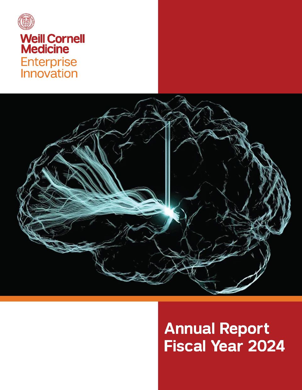 Light-based rendering of deep brain stimulation's electrical excitation of neuronal fiber pathways to treat patients with traumatic brain injury.