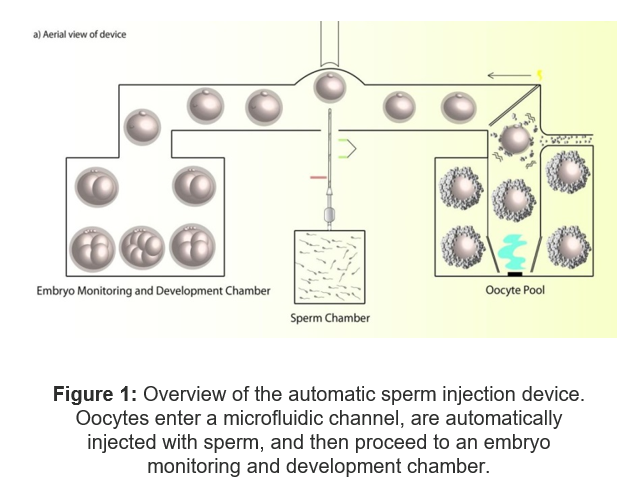 Overview of the automatic sperm injection device.