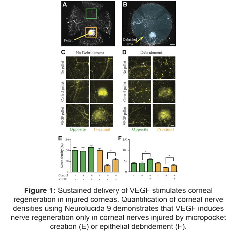 Sustained delivery of VEGF stimulates corneal regeneration in injured corneas.