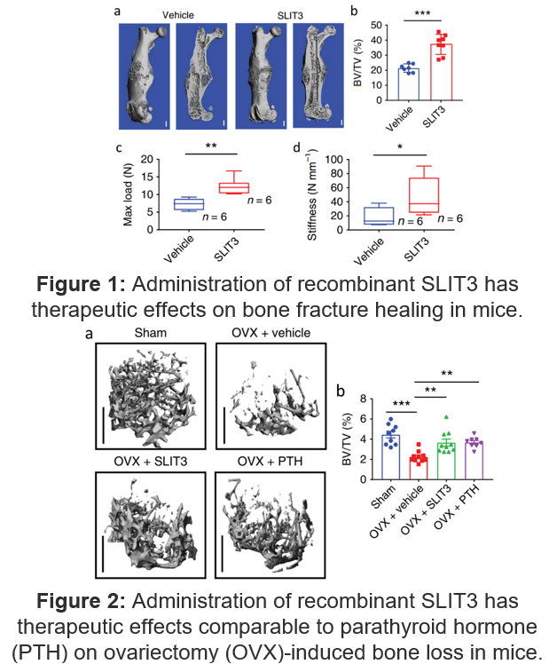 Image: administration of recombinant SLIT3 has therapeutic effects comparable to parathyroid hormone (PTH) on ovariectomy (OVX)-induced bone loss in mice.