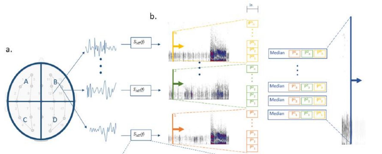 Image of overview of the signal processing method underlying the Median Power Spectrogram (MPS).