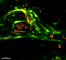 Image of a confocal micrograph of tumor induced angiogenesis in mechanically tuned (higher modulus) microenvironment using the 3D biomimetic platform.