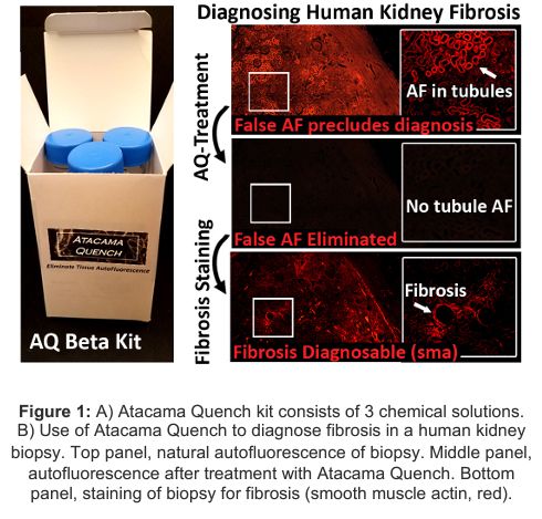 Image of Use of Atacama Quench to diagnose fibrosis in a human kidney biopsy.