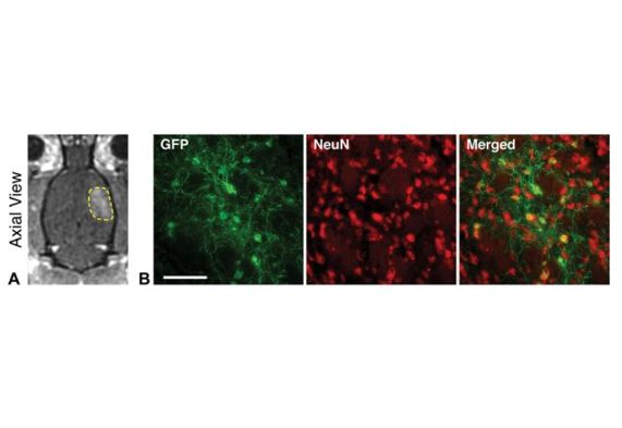 Figure of MRI-guided focused ultrasound facilitates targeted AAV-mediated gene delivery of GFP to the brain of live rats.