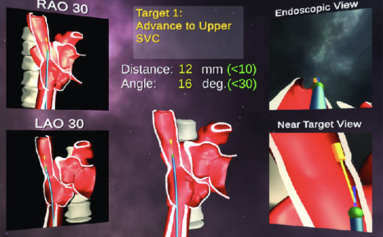 Figure of target 1 advance to SVC