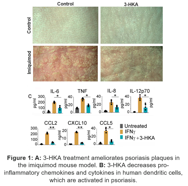 Figure: 3 HKA treatment ameliorates psoriasis plaques in the imiquimod mouse model.