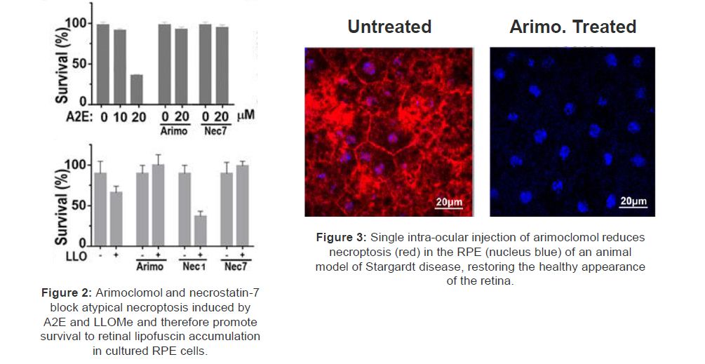 Data proving single intra-ocular injection of arimoclomol reduces necroptosis (red) in the RPE (nucleus blue) of an animal model of Stargardt disease, restoring the healthy appearance of the retina.