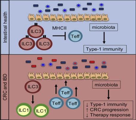 Dysregulation of ILC3s unleashes progression and immunotherapy resistance in colon cancer.