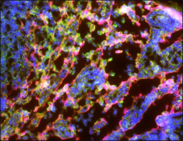 Immunofluorescence of a lymph node shows lymphatic endothelial cells contain the enzyme (labeled in green) that generates 3-HKA.