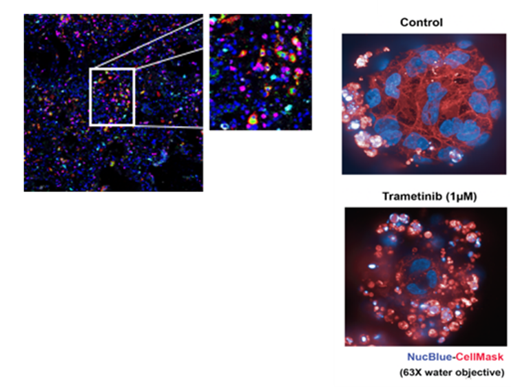 Images of mass cytometric analysis of liver tissue after liver injury and representative pictures of PM1230 colorectal organoids at 63X magnification.
