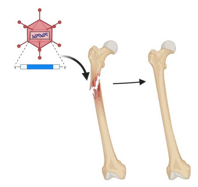Schematic of using adenovirus gene therapy for accelerated healing of orthopedic injuries.